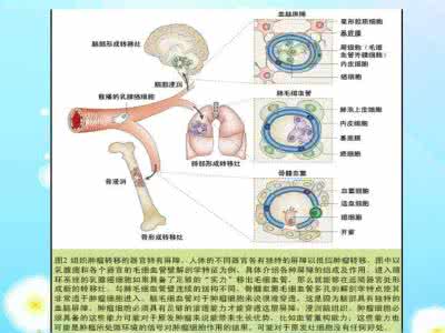 肿瘤的侵袭和转移 肿瘤转移的发生和其它