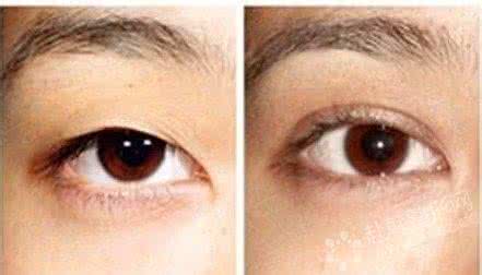 单眼皮好看还是双眼皮 单眼皮好看还是双眼皮比较好看