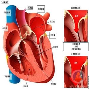 亨特综合症 亨特综合症 亨特综合症的并发疾病