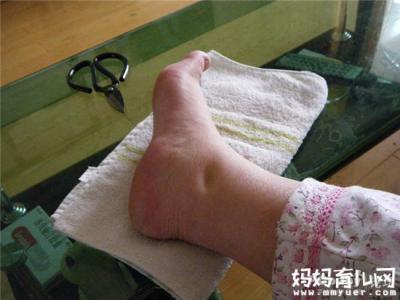 孕妇脚肿是什么原因 孕妇脚肿是什么原因 孕妇脚肿是什么原因造成的