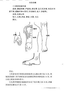 内伤咳嗽治宜 看图按摩治内伤咳嗽