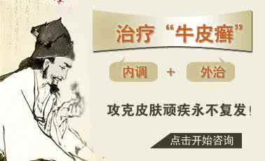 不要踏入静谧的良夜 不要踏入静谧的良夜 不要踏入牛皮癣的用药误区