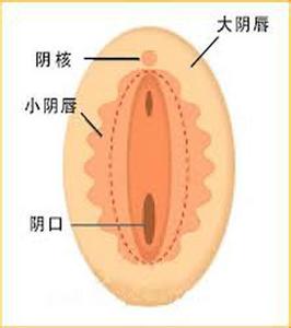 外阴白斑最真实图片 外阴白斑