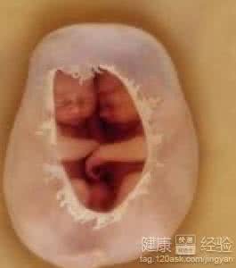 怀孕10几天可以药流吗 怀孕多久可以做药流