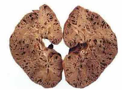 各式各样的椅子 各式各样的肾囊肿