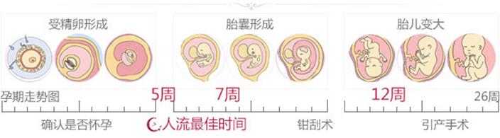 出现便秘是怀孕的征兆 怀孕征兆出现时间是什么时候