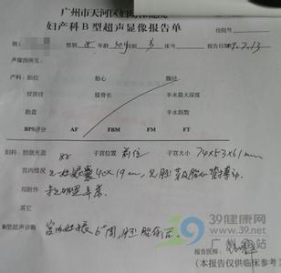 早孕检查什么时间做好 早孕检查需要检查什么 早孕检查时间