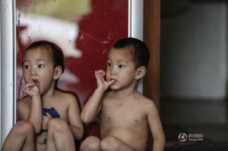 咬破手指 湖北双胞胎兄弟患无痛无汗症 咬破手指无知觉