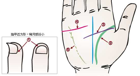 掌纹诊病图解 掌纹图解（之）手相掌纹诊病