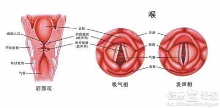 咽喉炎喉咙痛怎么办 喉咙有咽炎怎么办呢