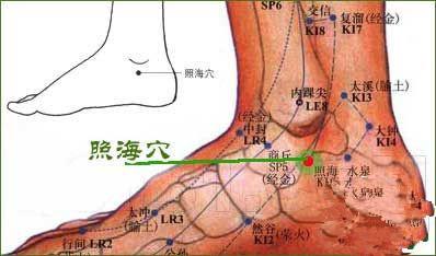 治疗便秘最快的偏方 便秘的拔罐疗法