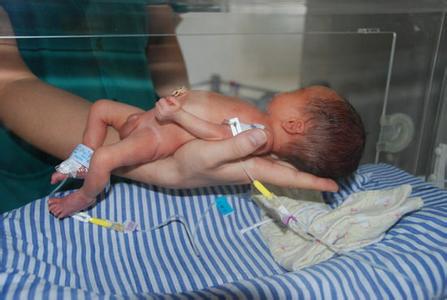 早产儿比较聪明 早产儿比较聪明 早产儿如何护理