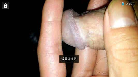 支原体感染的症状 支原体感染的症状 人们感染支原体的症状