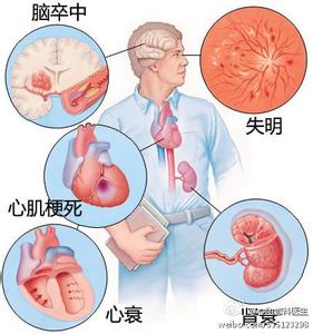 高血压 百度知道 图文：你真的知道什么是高血压、造成的原因及危害？