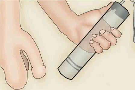 话语权 「性福」不「性福」：糖尿病有很大话语权