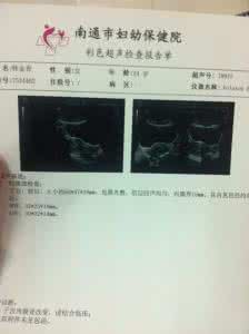 孕早期出血8种情况 孕早期B超适合什么情况