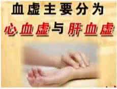 肝血虚吃什么中成药 肝血虚