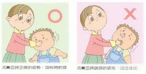 经常流鼻血吃什么好 流鼻血不适宜吃什么 7款处方快速止血