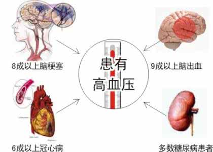 如何预防脑血管意外 脑血管意外 如何预防脑血管意外