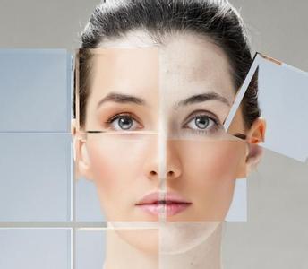 嘴角黑色素沉淀小妙招 8个妙招能教你如何赶走黑色素