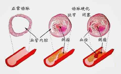 肠道保健品 肠道保健从“肠”计议
