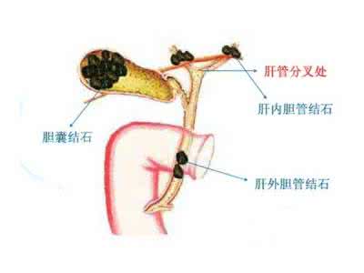 治疗高血压最好的方法 治疗高血压的体操方法...