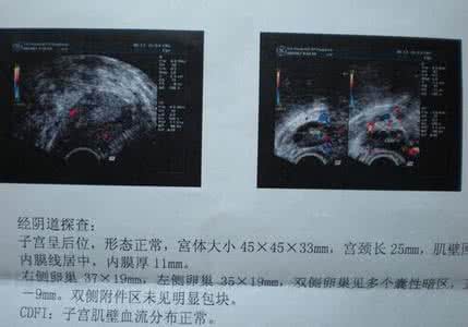 b超可以检查什么 孕期b超检查 孕期照B超的好处有哪些？