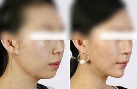 瘦双下巴的小妙招 双下巴怎么减 6妙招让你拥有迷人下巴