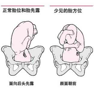 什么时候定胎位最好 什么时候检查胎位