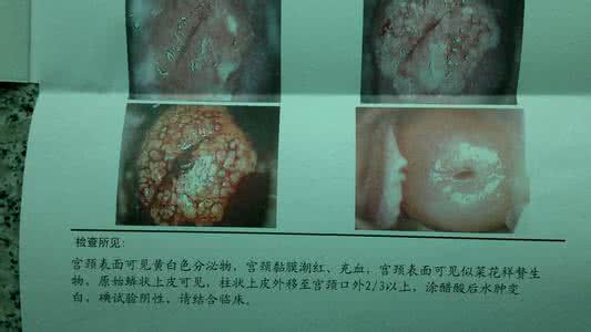 月经没来验孕棒一条线 月经没来也没怀孕怎么回事