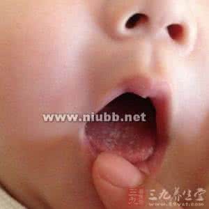 舌苔怎样去除最快方法 如何提早发现宝宝生病征兆？看舌苔法大全
