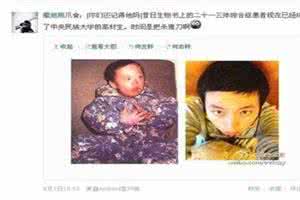 21三体综合征能治吗 21三体综合症 21三体综合征的因素是什么