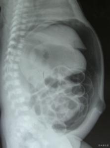 治疗肝腹水有哪些秘方 秘医学难题肝腹水,竟然被一片寻常叶子解决了!