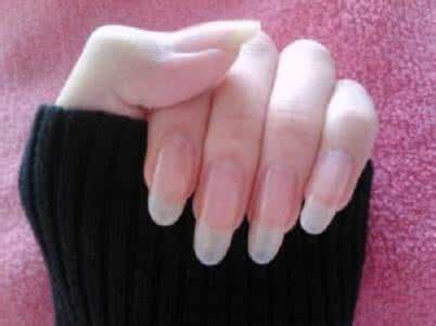 指甲竖线预示什么病 指甲上竖线预示什么