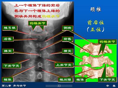 颈椎解剖图 颈椎X，CT,MRI解剖阅片