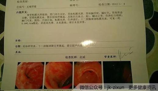 做完胃镜后胃疼 做完胃镜后胃疼 做完胃镜后能运动吗