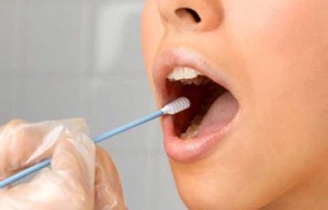 唾液分泌过多总咽口水 唾液总咽进气管 总咽唾液好吗?