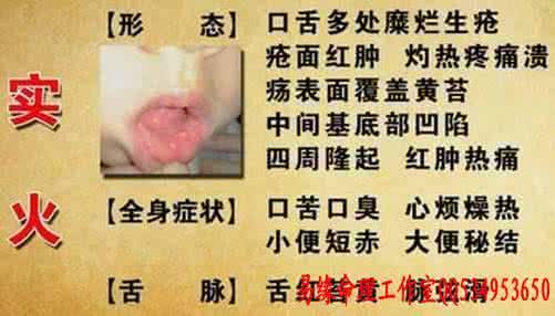 实火与虚火的区别 【健康】实火还是虚火