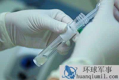 男性盆腔少量积液 男性如果精液量少怎么补