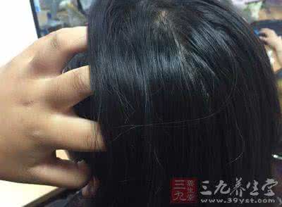男士防脱发吃什么食物 脱发吃什么好 常吃这几种食物拥有乌黑秀发