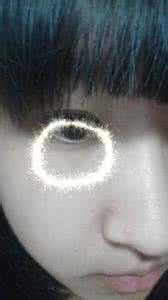 天生黑眼圈很重怎么办 有黑眼圈，怎么办