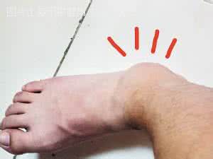 跌打损伤用什么药最快 跌打损伤