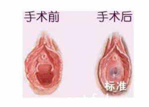 静脉输液流程口述 口述：输在处女膜上的爱情故事