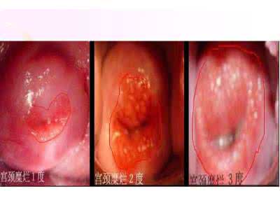 生殖与避孕 生殖与避孕 生殖健康与避孕