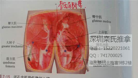 腰突的最佳治疗方法 叶氏治疗腰突十法