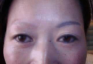 激光洗眉后感觉毁容了 激光洗眉后感觉毁容了 维纳斯激光,体会“清白”的感觉