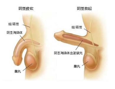 阴茎勃起困难什么原因 影响大阴茎勃起困难的几个因素