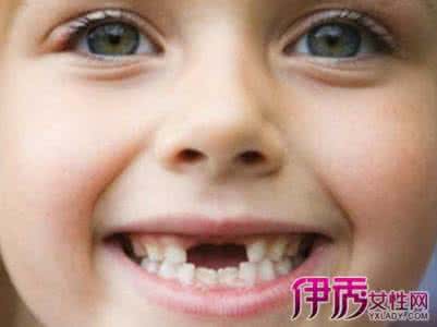 6岁宝宝换牙 6岁宝宝换牙 【漫画】0-6岁宝宝这样“养”出好牙!