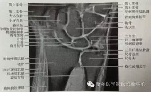 尺骨撞击综合症 尺骨撞击综合症 尺骨撞击综合症的病因及治疗方法