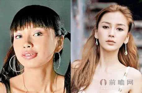整容改变命运 整容改变命运 为什么微整让这些人的命运改变了？